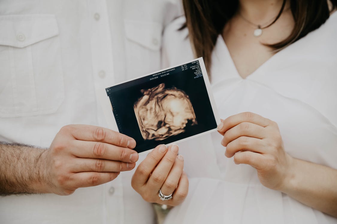 Foto de gestante em casa segurando foto do ultrassom do bebê