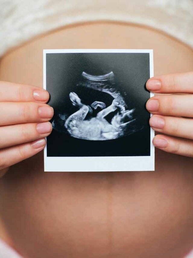 Grávida segurando ultrassom, retratando um feto em sono intrauterino, na frente de sua barriga.