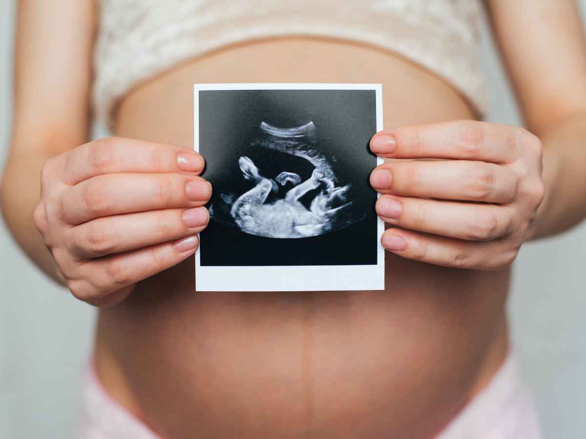 Grávida segurando ultrassom, retratando um feto em sono intrauterino, na frente de sua barriga.