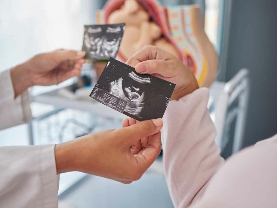 Médica mostrando ultrassom de bebê em sono intrauterino.